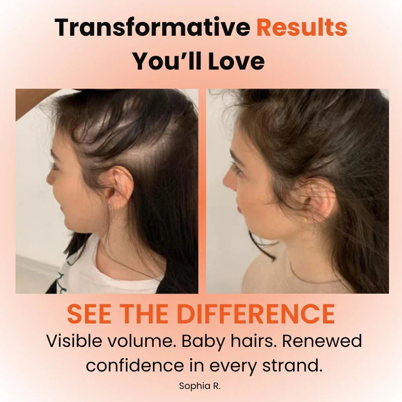 Veliva™ Pumpkin Seed Oil with Saw Palmetto