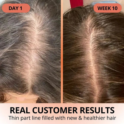 Veliva™ Pumpkin Seed Oil with Saw Palmetto