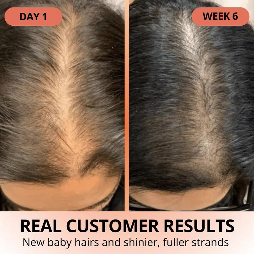 Veliva™ Pumpkin Seed Oil with Saw Palmetto