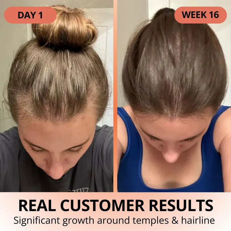 Veliva™ Pumpkin Seed Oil with Saw Palmetto