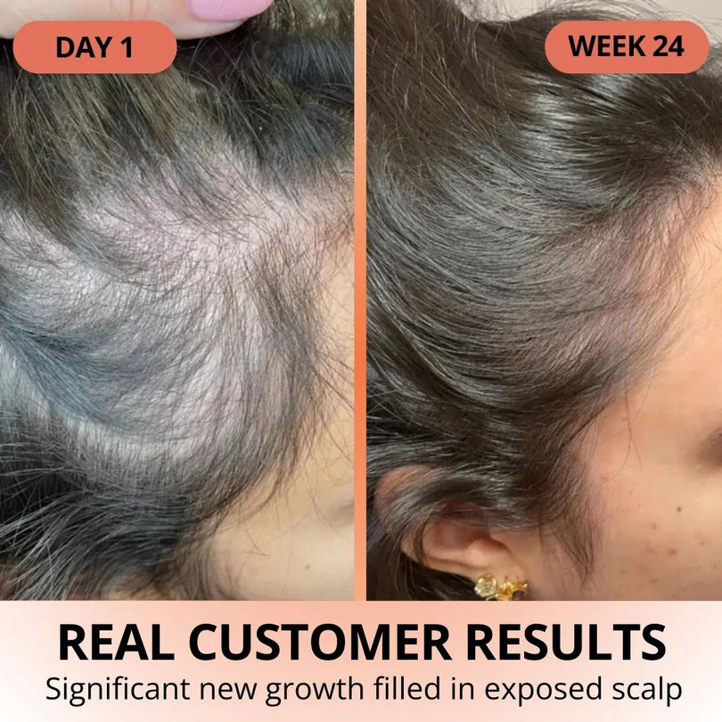 Veliva™ Pumpkin Seed Oil with Saw Palmetto