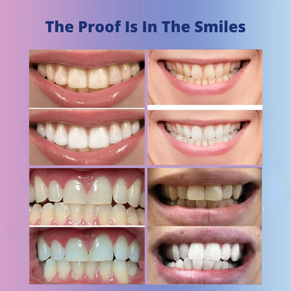 Veliva™ Whitening Strips