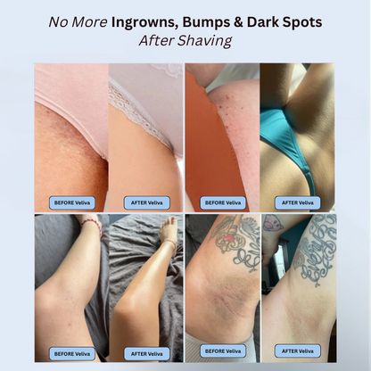 Veliva™ Smoothing Solution